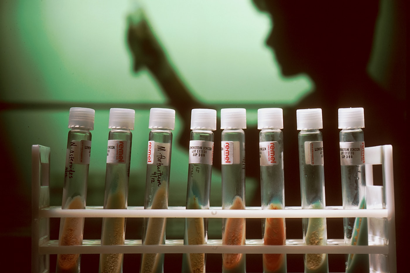 Laboratory vials prepared for diagnostic research